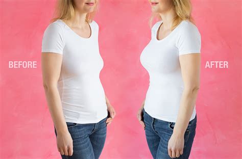 woman breast expansion|Breast Augmentation: Before and After Photos That Wow.